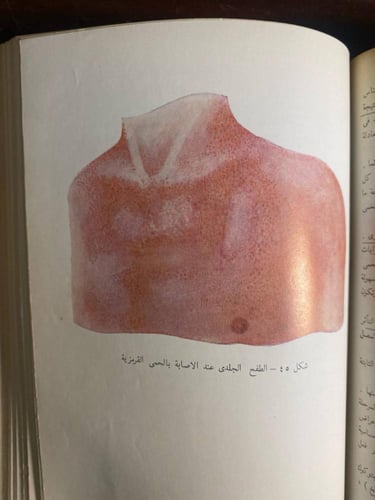 امراض الاطفال -٣ مؤلفين (K2)