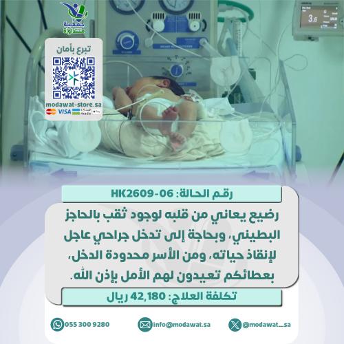 A baby suffering from a hole in the heart and in n...