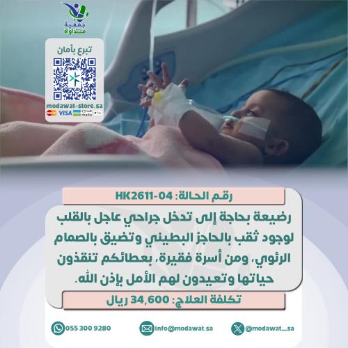 رضيعة تعاني من وجود ثقب بالقلب (رقم الحالة: HK2611...