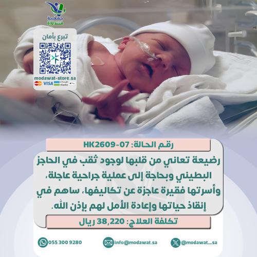 Infant suffering from her heart due to a ventricul...