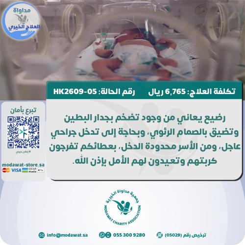 Infant suffering from the presence of a narrowing...