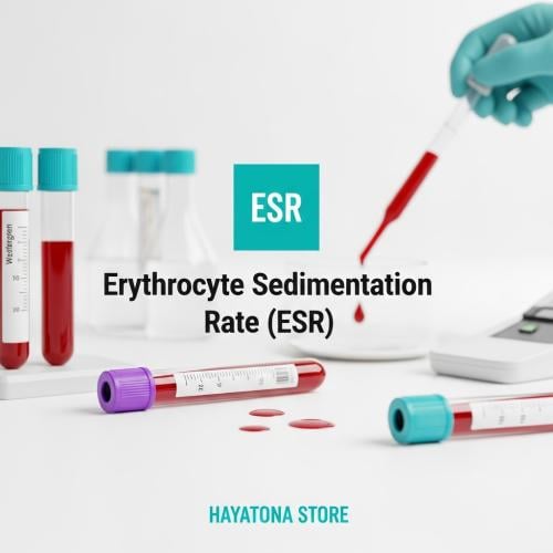 سرعة ترسيب كرات الدم الحمراء- Erythrocyte Sediment...