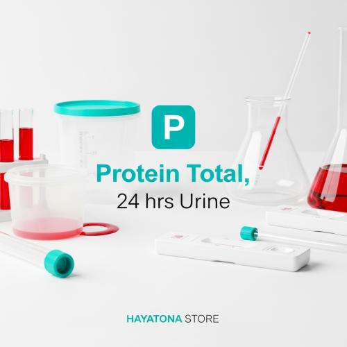 البروتين الكلي في البول (٢٤ ساعة) - Protein Total,...