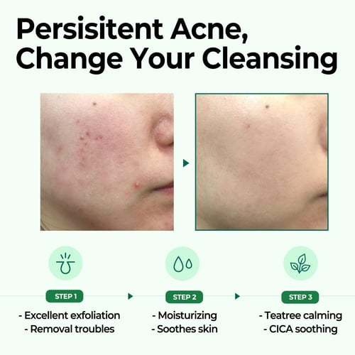 صابونة المعجزة الكورية لتنظيف البشرة من سوم باي مي...