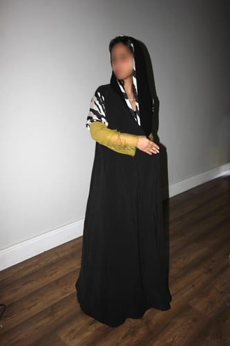 تايقر دانتيل