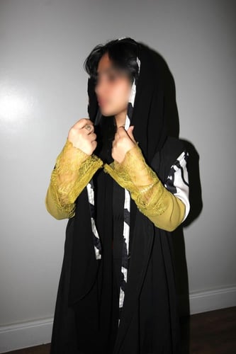 تايقر دانتيل