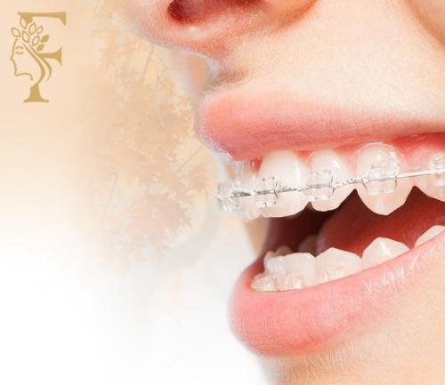 تقويم علاجي فك واحد