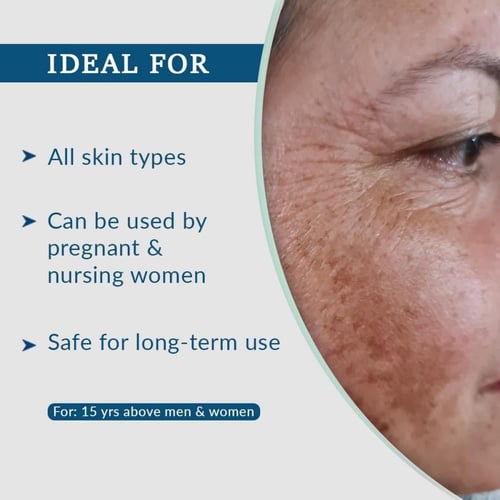 لفترة محدودة حبة +حبة هدية إف سي إل الفا هيدروكسي...