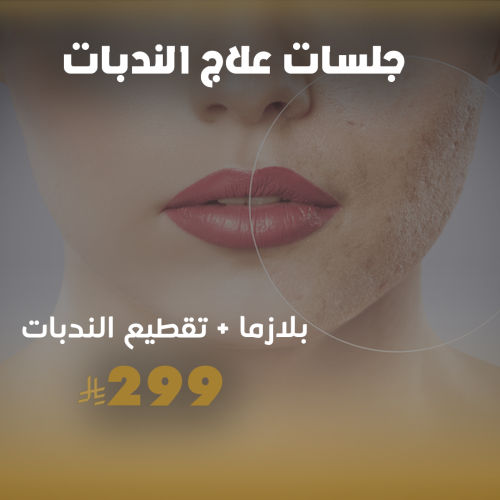 تقطيع الندبات مع البلازما لعلاج الندبات