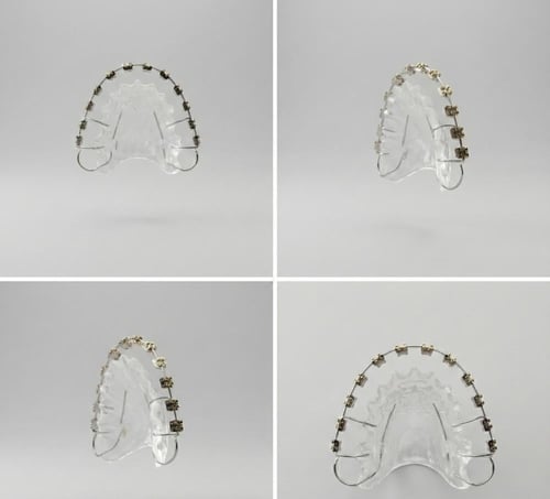 مثبت تقويم اسنان بدون غراء