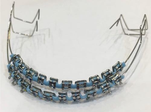 فكين تقويم زينه تركيب بدون غرا