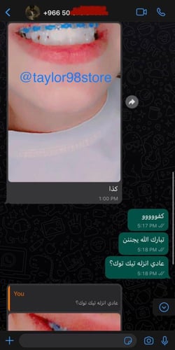 تقويم اسنان فك واحد تركيب بغرا مع بكج كامل وهدايا...