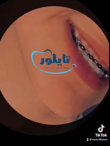 تقويم زينه منفصل تركيب غراء ثنين