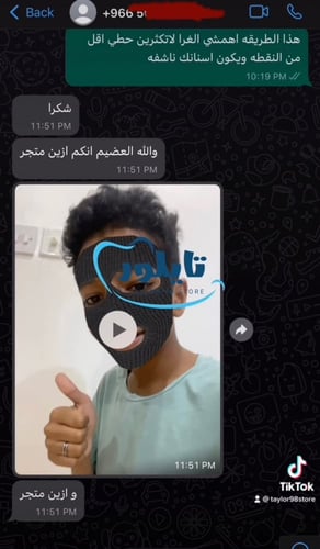 فكين تقويم زينه متصل تركيب غراء