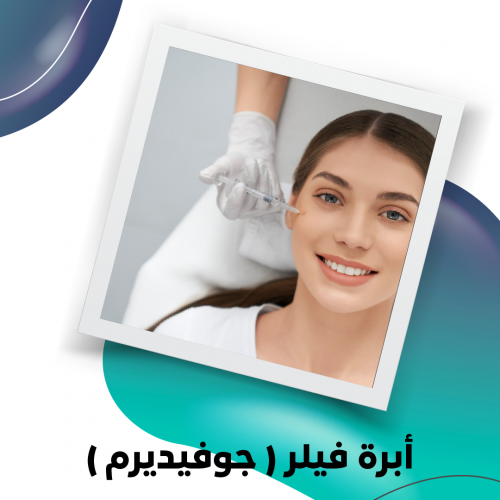 أبرة فيلر (جوفيديرم)