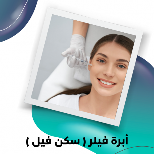 أبرة فيلر (سكن فيل)