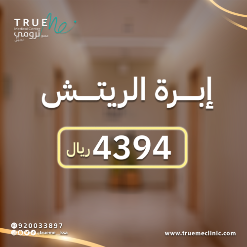 إبــرة الريتـــش