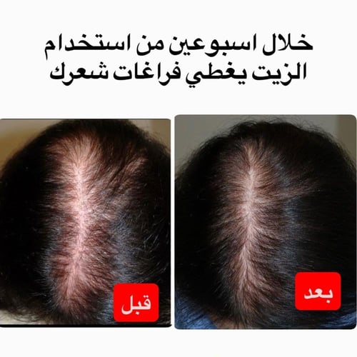 علبه زيت الجدايل للشعر 200مل