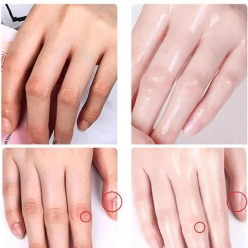 كريم تبييض اليد بنياسيناميد وأربوتين وإزالة التجاع...