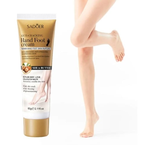 كريم لليدين والقدمين لاصلاح تشققات جلد اليد والقدم...