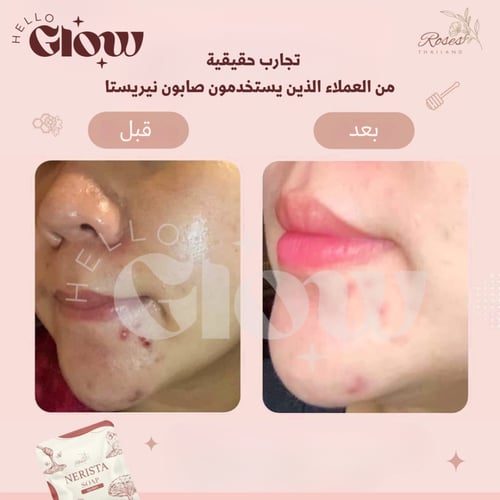 صابون نيريستا الاصلي - Nerista soap