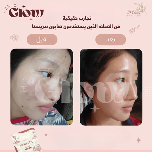 صابون نيريستا الاصلي - Nerista soap