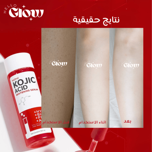 سيروم كوجيك اسيد من ابوت مي - About Mee Kojic Acid...