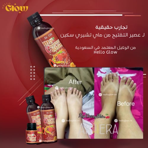 بودرة ماي تشيري سكين - Akhera My Cherry Skin ADVAN...