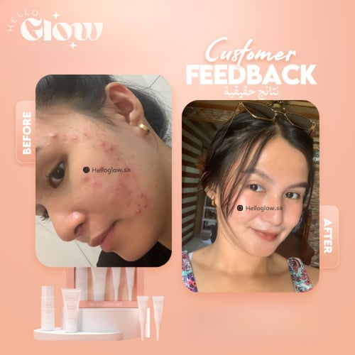 مجموعة ريفيتا قلو للوجة - Esme skin NEW Revitalizi...