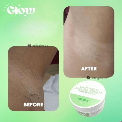 كريم تقشير الابط من كلاريتي Underarm Peeling Cream...