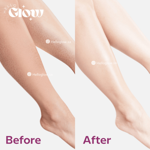 صابون التبييض بالكولاجين من كي قلو - K GLOW Collag...
