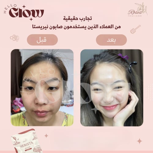 صابون نيريستا الاصلي - Nerista soap