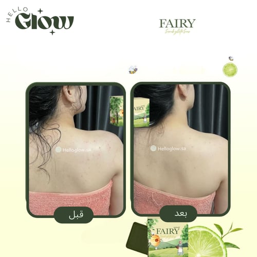 صابون جلوتا فيري - Fairy Scrub Gluta Soap