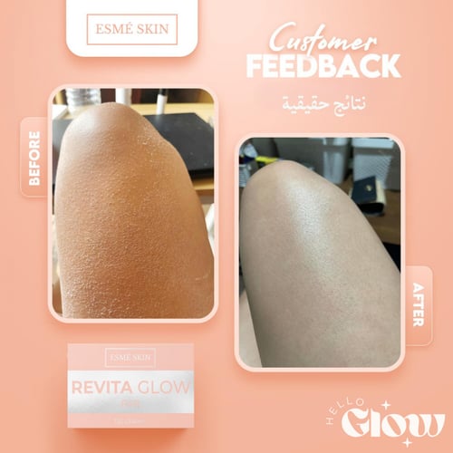صابون ريفيتا - Esme Skin Revita Glow soap