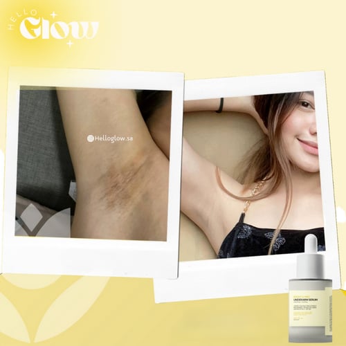 سيروم تفتيح الاندرارمز من كات آند كو - Catt & Co....