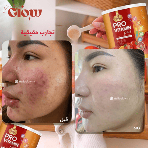 كولاجين الفيتامينات - Jellys Thailand Pro vitamin...