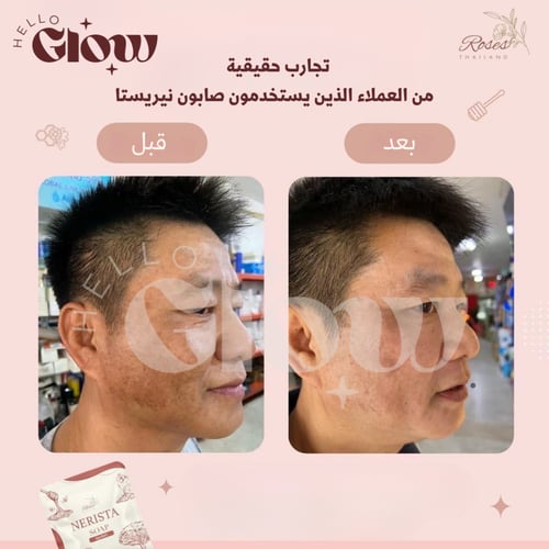 صابون نيريستا الاصلي - Nerista soap