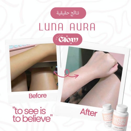 كبسولات هوب قلو المطور - Luna Aura Hope Glow Skin...