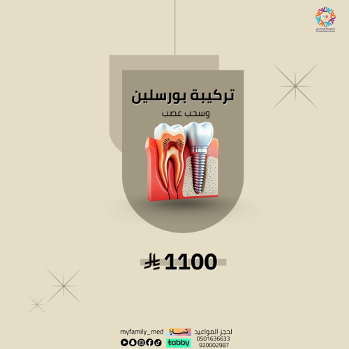 سحب عصب + تركيبة بورسلين