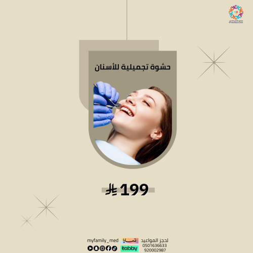 حشوة تجميلية للاسنان