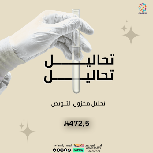 تحليل مخزون التبويض