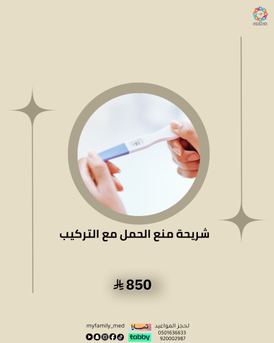 شريحة منع الحمل مع التركيب