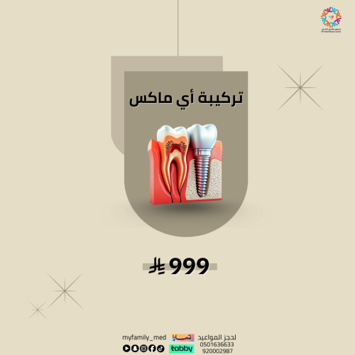 تركيبة أسنان اي ماكس
