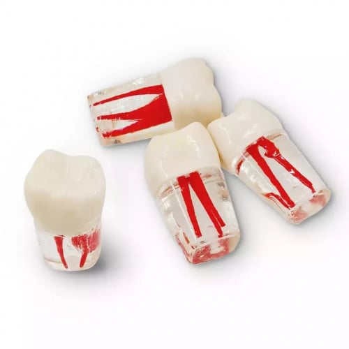 Endo Teeth
