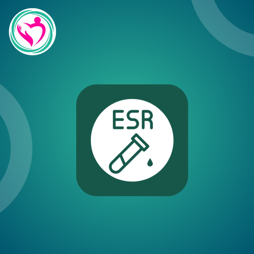 ESR automated-سرعة ترسب الدم