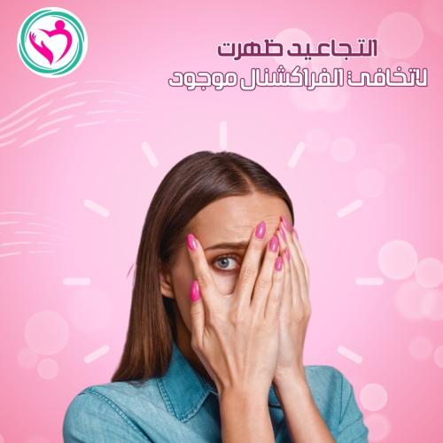 ليزر فراكشنال