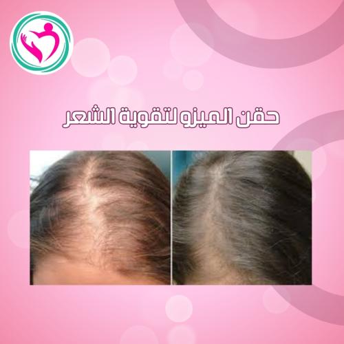 ميزو ثيرابي للشعر