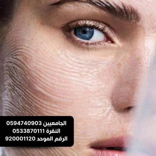 جلسة فراكشنال ليزر