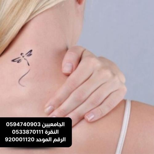 جلستين ازلة التاتو المتوسط