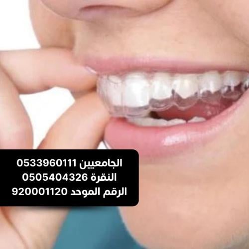 تبييض الاسنان المنزلي